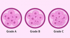 胚胎等级决定了孩子质量吗