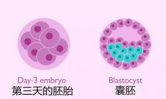 做试管移植鲜胚好还是冻胚好